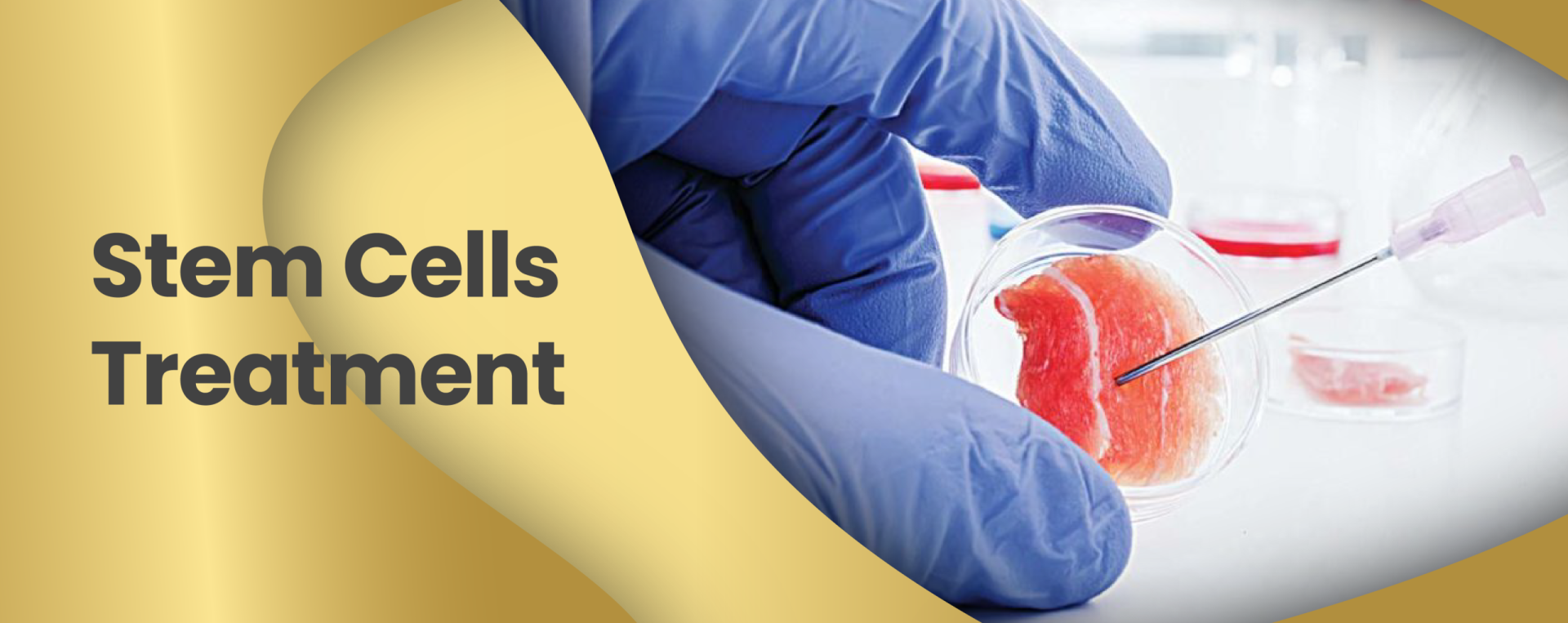 Stem cell therapy Malaysia treatment planning and regenerative medicine consultation