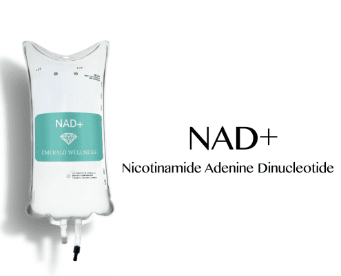 nad profile test