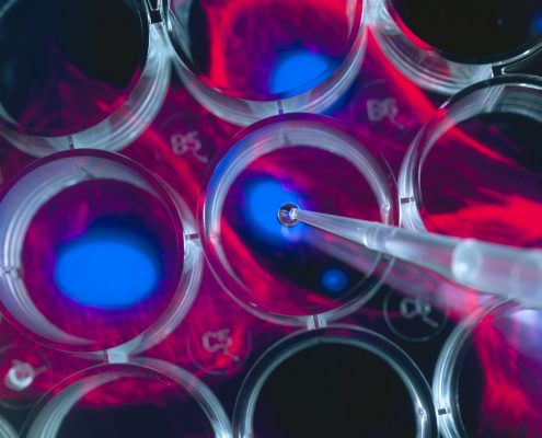 Mesenchymal Stem Cells