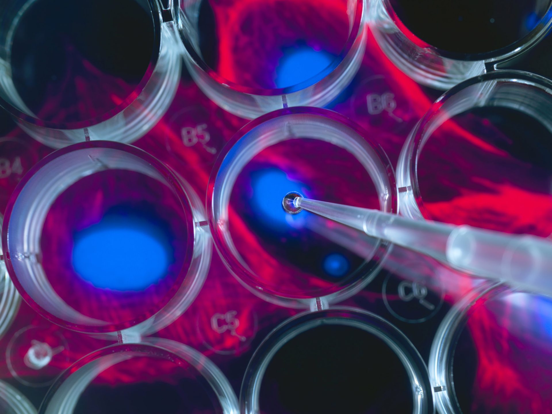 Mesenchymal Stem Cells