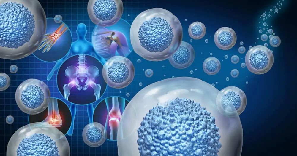 Adult stem cells for targeted diabetes regenerative medicine planning in Malaysia