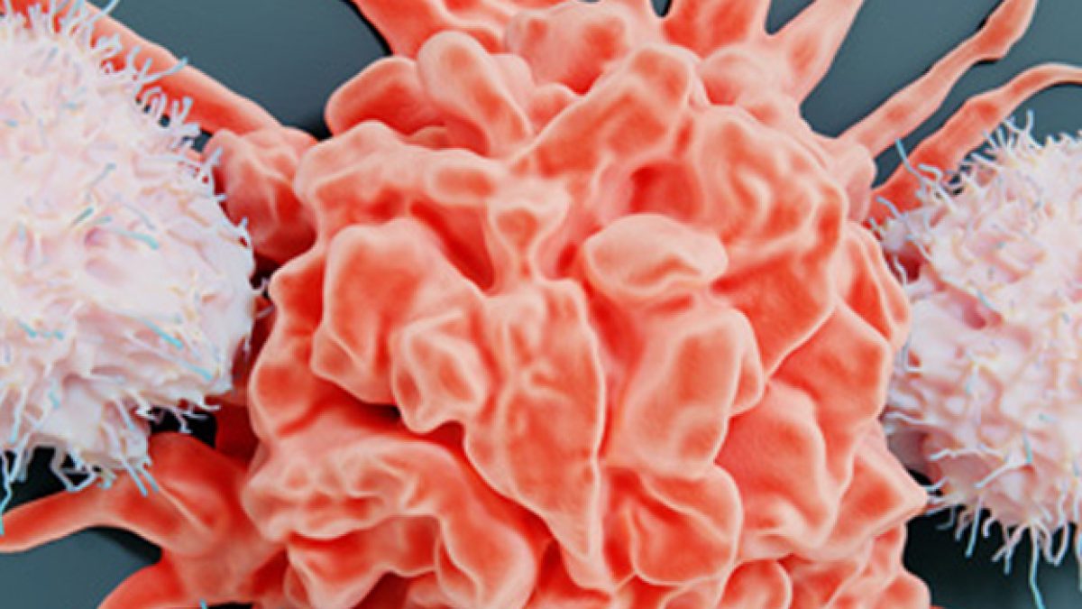 Immune cell therapy Malaysia oncology support and NKT treatment planning