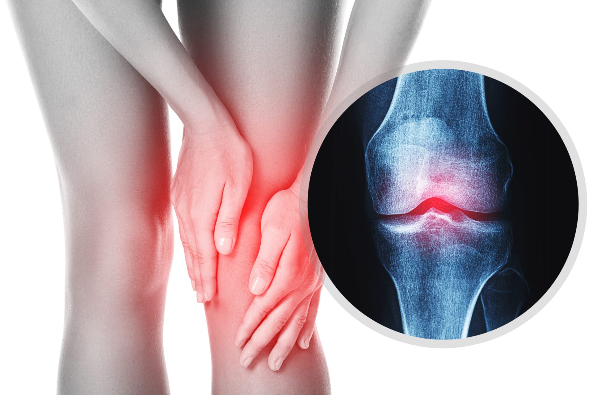 Osteoarthritis joint pain Malaysia stem cell and exosome suitability review