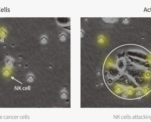 nk cell activity test