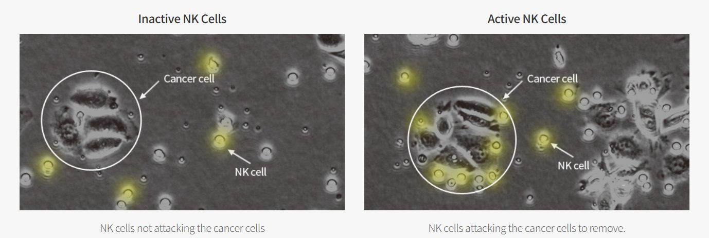 nk cell activity test