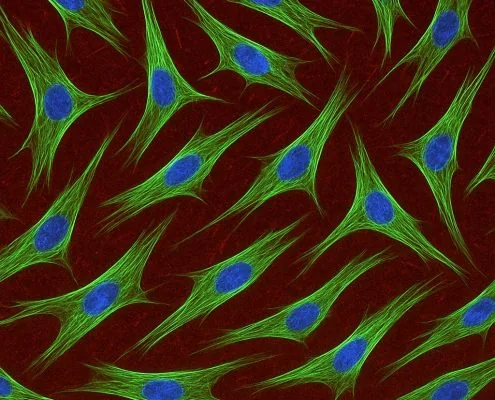 Bone Marrow Stem Cells